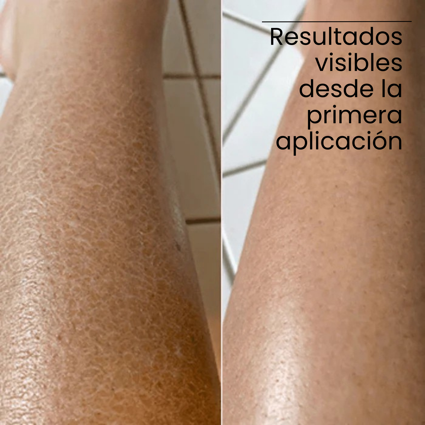 SKINGLOW OIL DE ALOE VERA & VITAMINA E