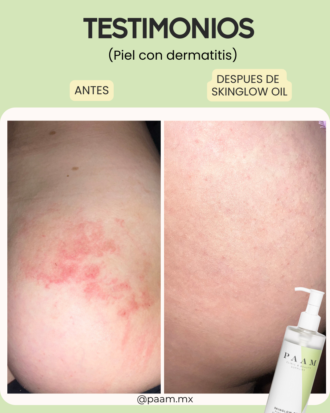 SKINGLOW OIL DE ALOE VERA & VITAMINA E